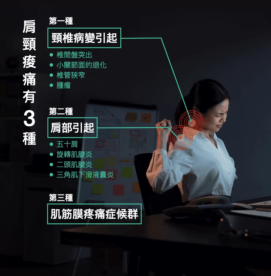 《疼痛知識懶人包》肩頸痠痛神救星 – 精準療法! 《疼痛知識懶人包》肩頸痠痛神救星 – 精準療法!